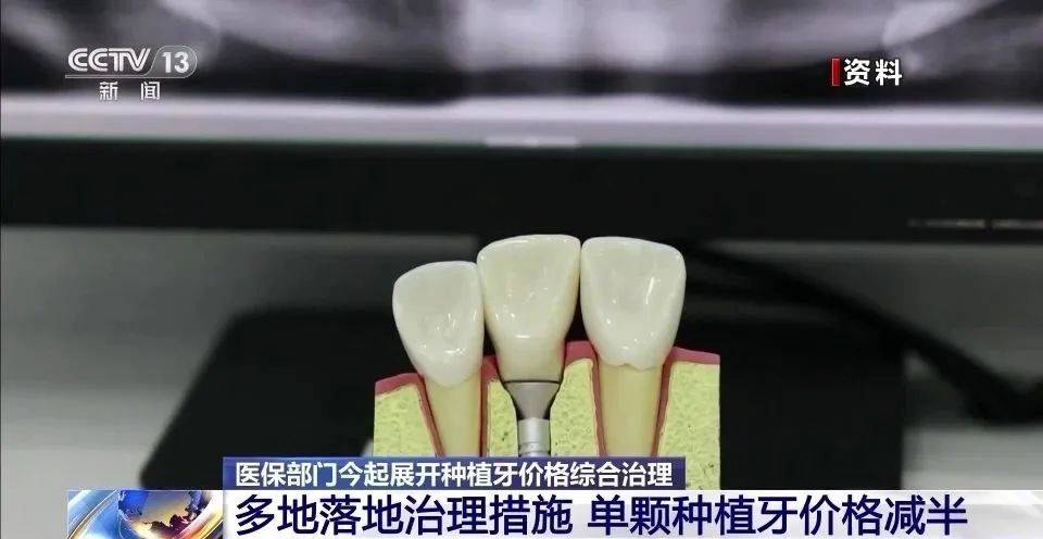 价格大降50%！今日起<strong></p>
<p>以太币价格今日价格</strong>，落实！