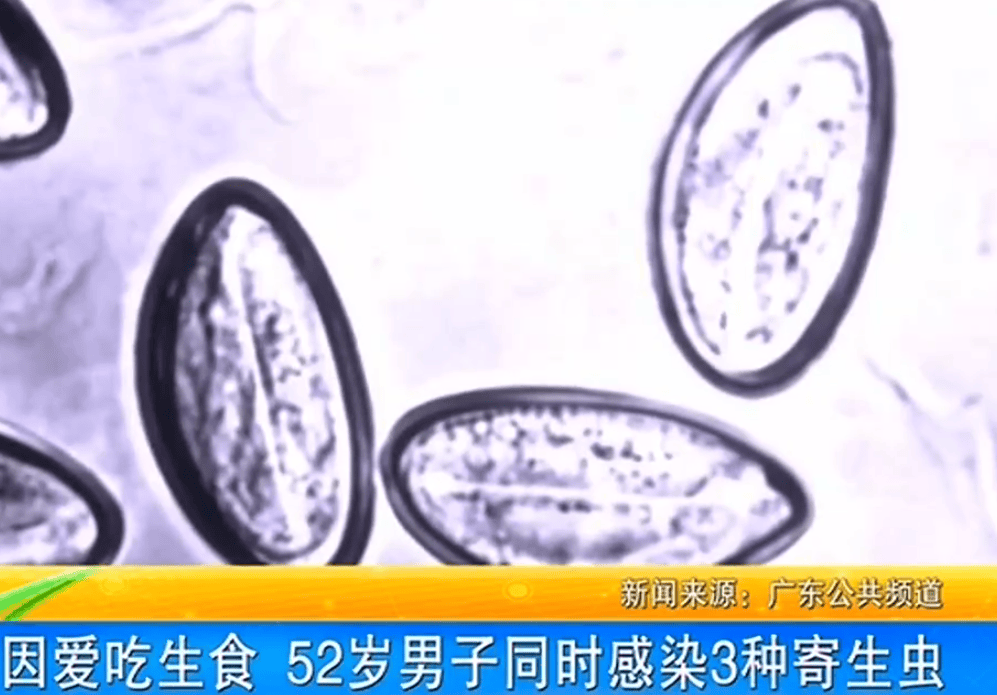 女子体内排出10米长绦虫<strong></p>
<p>证券从业人员资格考试</strong>！原是两年前旅游时吃了这种食物
