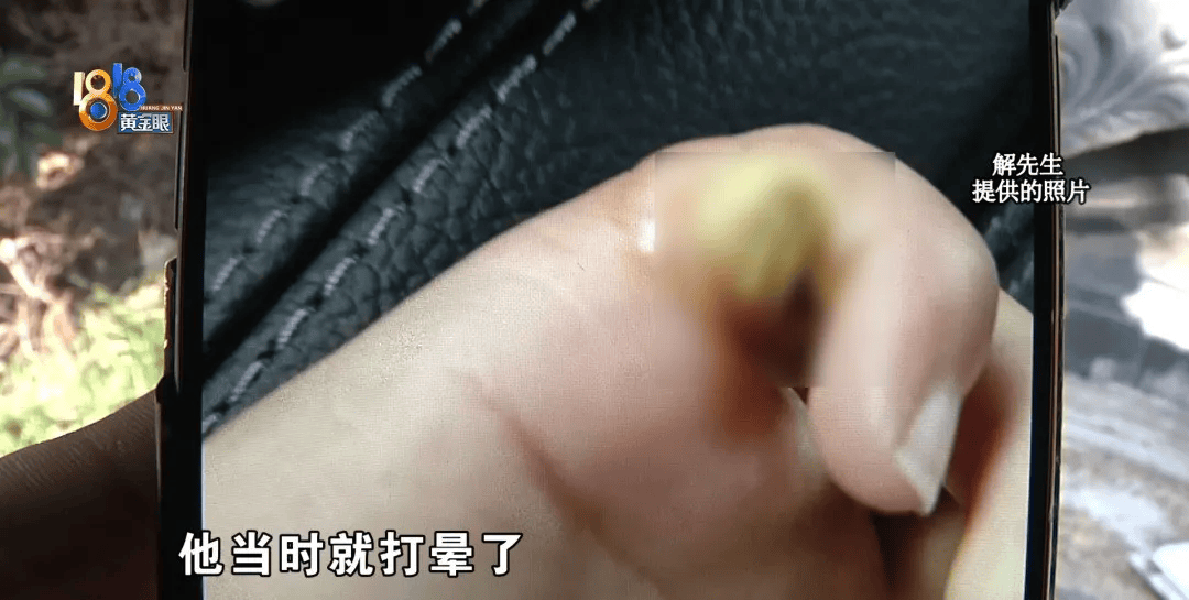 5岁男童瞬间晕厥<strong></p>
<p>美国虚拟币</strong>，筋都断了！街上常见，看见立即远离