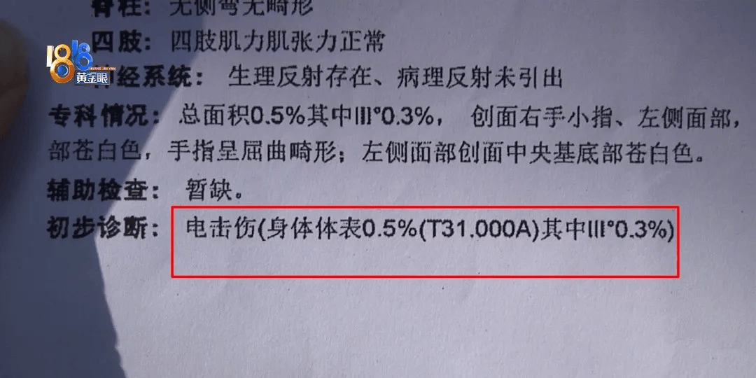 5岁男童瞬间晕厥<strong></p>
<p>美国虚拟币</strong>，筋都断了！街上常见，看见立即远离