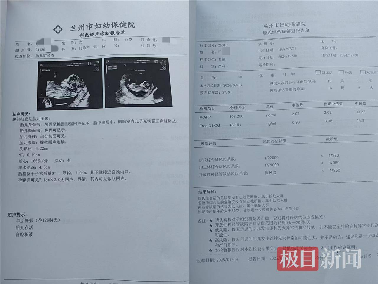 二胎出生查出先天性病症或落下残疾<strong></p>
<p>虚拟币eos</strong>，残疾父母称医院产检漏检、未尽告知义务，医院及医调委回应