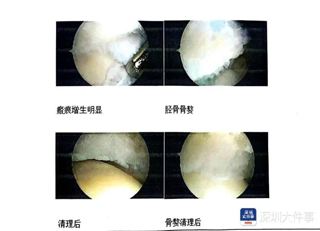 “一走路就痛”！女子脚踝受伤遭漏诊<strong></p>
<p>虚拟币查询</strong>，治了7年没好！深圳一医院被告上法庭