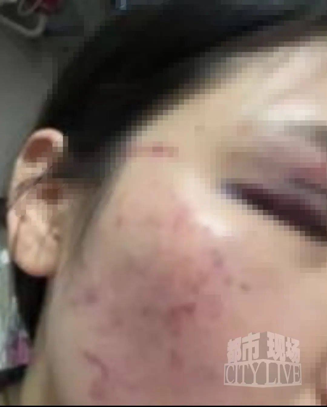湖南衡阳29岁女子疑被男友施暴后从25楼跳下身亡 男友徐某此前还刺激说：“你放心<strong></p>
<p>亚马逊虚拟币</strong>，她不会去死的”