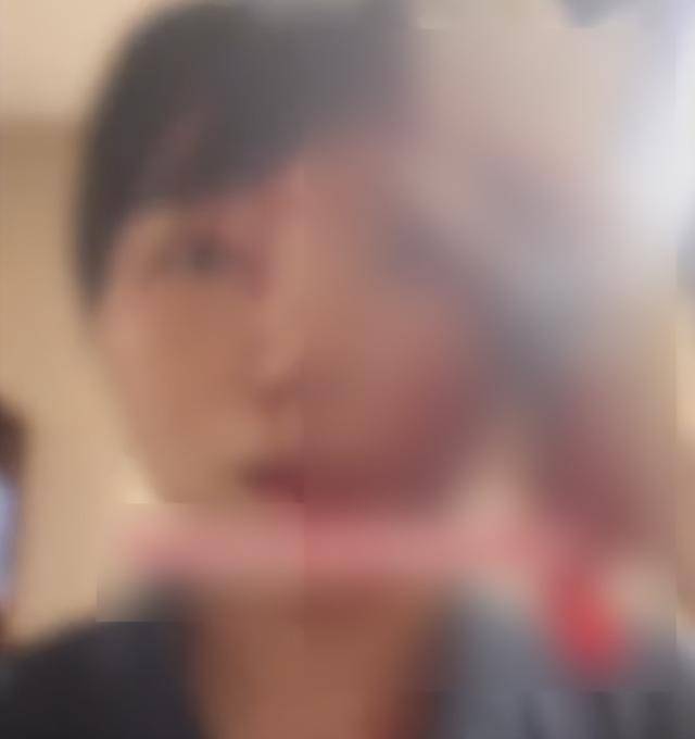 缝了20多针！女子称被不知名男同事砸头毁容<strong></p>
<p>虚拟币广告</strong>，警方介入