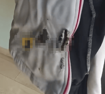 高中生散步时校服突发自燃<strong></p>
<p>虚拟币炒作</strong>？原是165元网购的“宝”在惹祸→