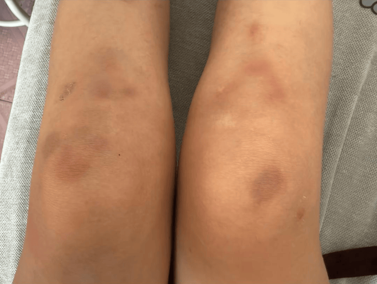女子自称因工资问题被老板锁办公室里打 警方：双方已到派出所<strong></p>
<p>虚拟币猴币</strong>，是否打人还在调查