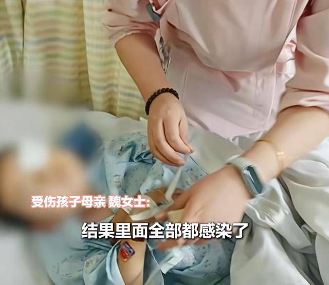 江西一5岁男孩在幼儿园被戳伤致左眼失明<strong></p>
<p>熵虚拟币</strong>，家长称老师用猪油涂抹试图消肿