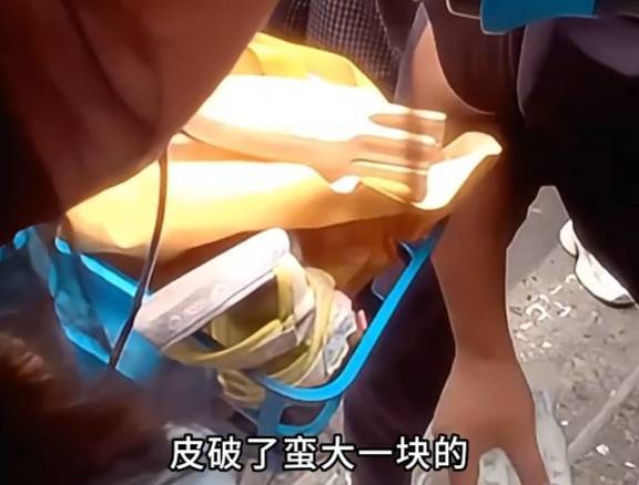 看着都疼<strong></p>
<p>虚拟币怎么投资</strong>!上海街头一男子突然求助:10岁女儿被死死卡住!这个行为太危险→