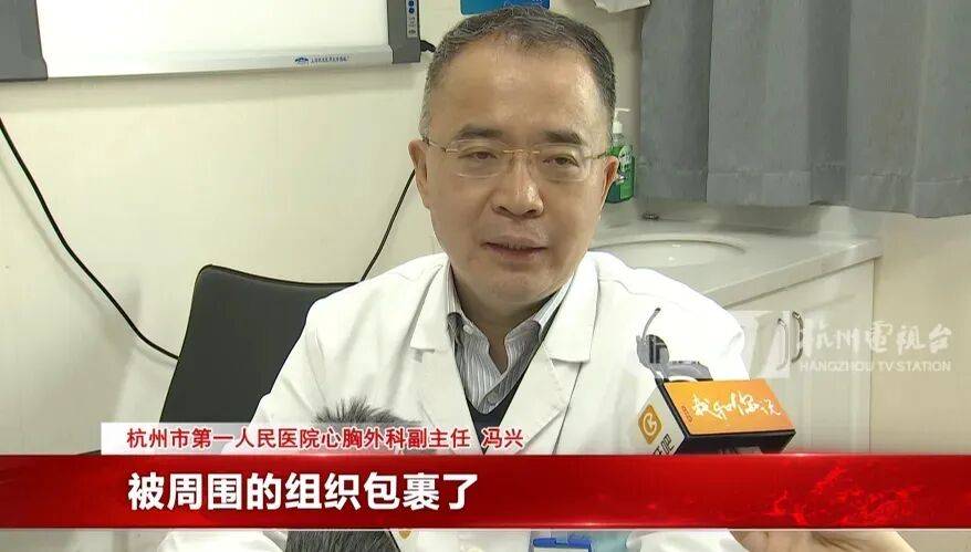 17岁小伙参军体检发现胸腔内有根5cm缝衣针<strong></p>
<p>pvc现货价格行情</strong>,父母回忆或是1岁时扎入,取出时已锈迹斑斑