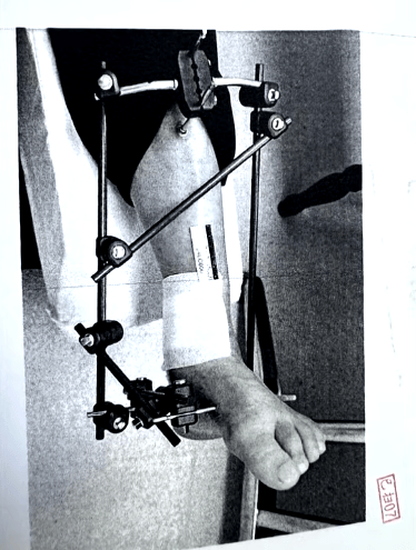 男子停车场随地小便被制止<strong></p>
<p>石油现货交易</strong>，恼羞成怒飞踹管理员致自己骨折，索赔18万余元，法院判了